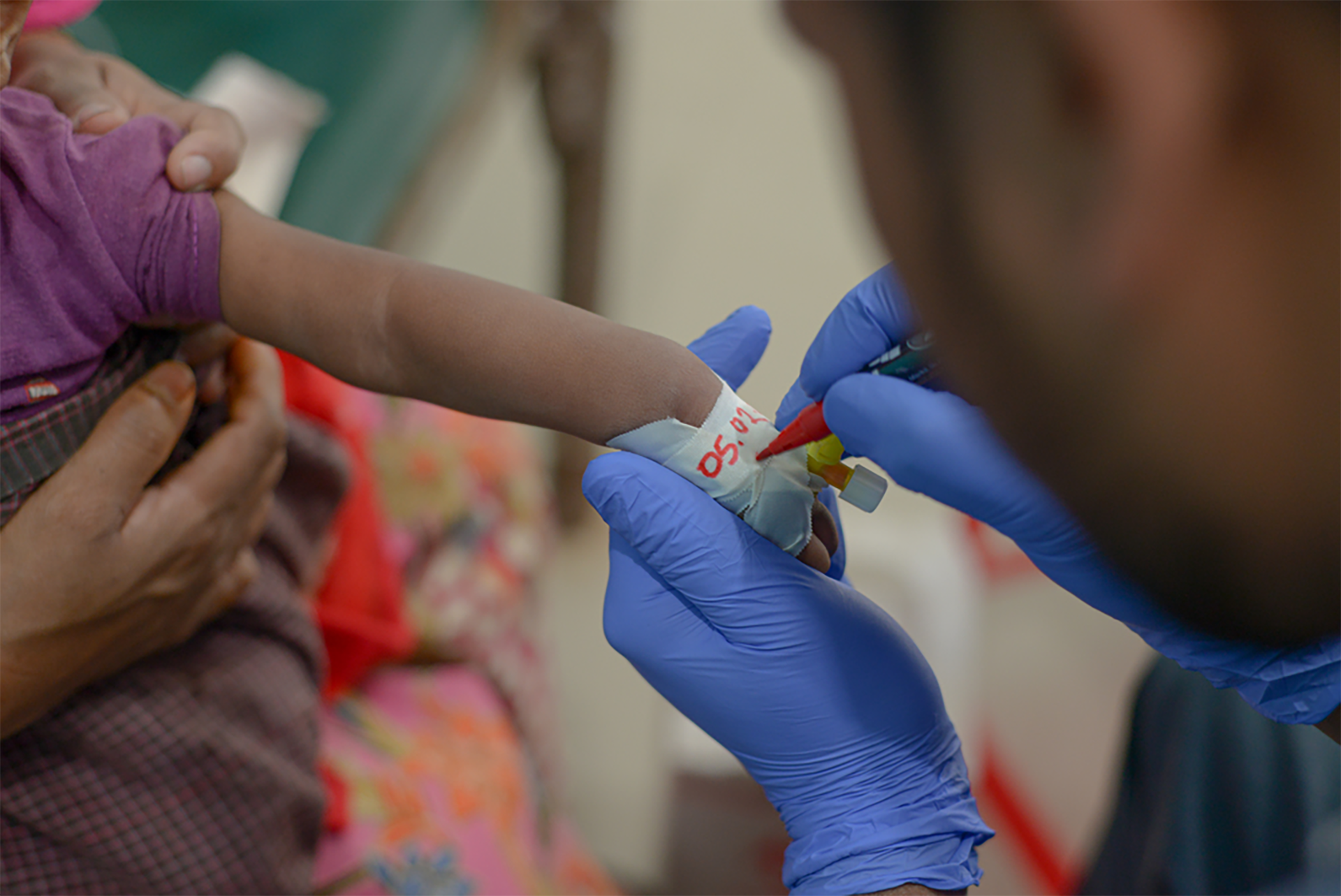 MSF nurse writes on the bandage covering Atiullah&#039;s cannula. © Tariq Adnan/MSF