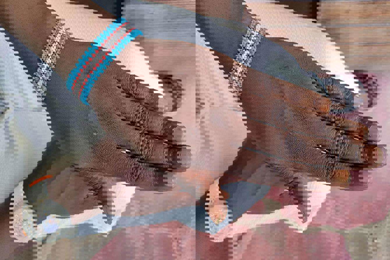 關鍵族群普遍承受更高健康風險和心理健康問題，但在東非肯尼亞，他們卻飽受歧視，例如求醫被拒、被醫護人員不當提問、粗暴評論或敵意注視，難以得到所需醫療護理。